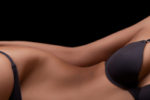 Breast implant removal & revision Chicago