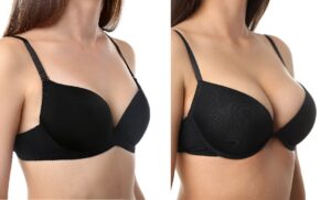 Breast Lift and Implants Before and After Photos